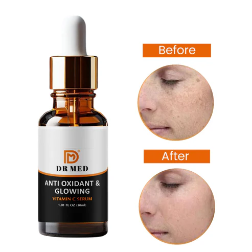 Vitamin C Serum - Nicanimide 10% Anti Oxidant & Glowing. 30ml