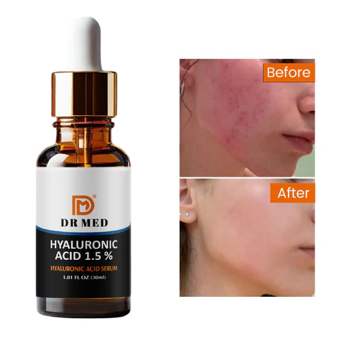 Hyaluronic Acid serum: Deep hydration - hyaluronic 1.5% 30ml